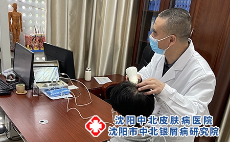 沈陽(yáng)專治牛皮癬的醫(yī)院:紅皮型牛皮癬都有哪些危害存在? 沈陽(yáng)專治牛皮癬的醫(yī)院:紅皮型牛皮癬都有哪些危害存在?