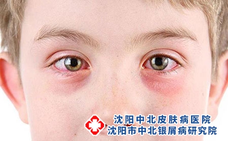 2 (273)眼睛 2 (273)眼睛