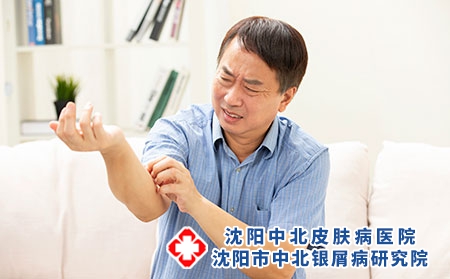 攝圖網_501661567_中年人男性手臂皮膚瘙癢(企業商用) 攝圖網_501661567_中年人男性手臂皮膚瘙癢(企業商用)