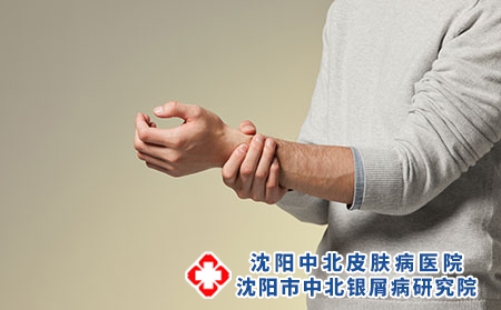 攝圖網(wǎng)_501528683_青年男性手腕疼痛(企業(yè)商用)關(guān)節(jié) 攝圖網(wǎng)_501528683_青年男性手腕疼痛(企業(yè)商用)關(guān)節(jié)