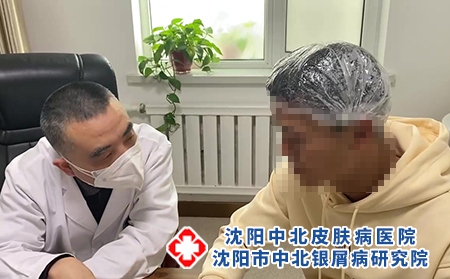 沈陽銀屑病名中醫-沈陽中北銀屑病醫院-沈陽牛皮癬防治醫院 沈陽銀屑病名中醫-沈陽中北銀屑病醫院-沈陽牛皮癬防治醫院